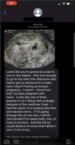 File:2021.08.06 LO twin ultrasound text.jpg